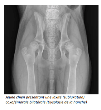 une laxité (subluxation) coxofémorale bilatérale (Dysplasie de la hanche)