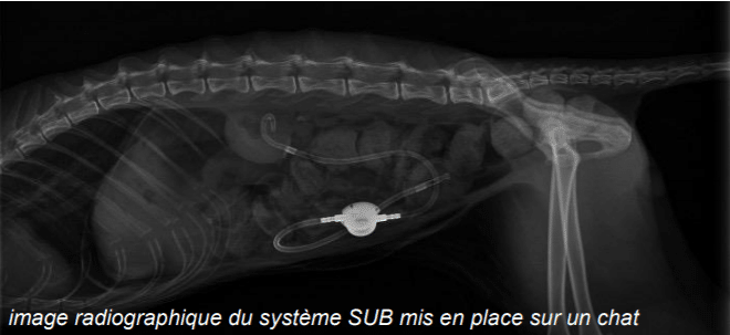 Radiographie du système SUB